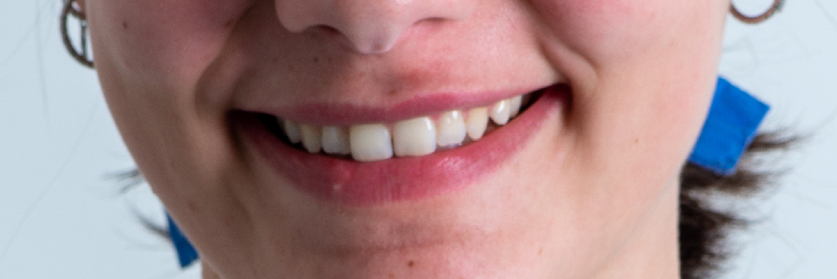 Cura del Sorriso prevenzione dentale