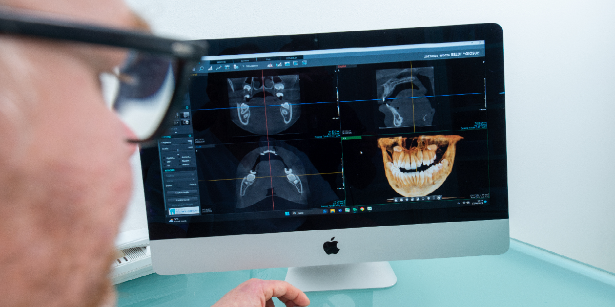 Impronta dentale con tecnologia digitale